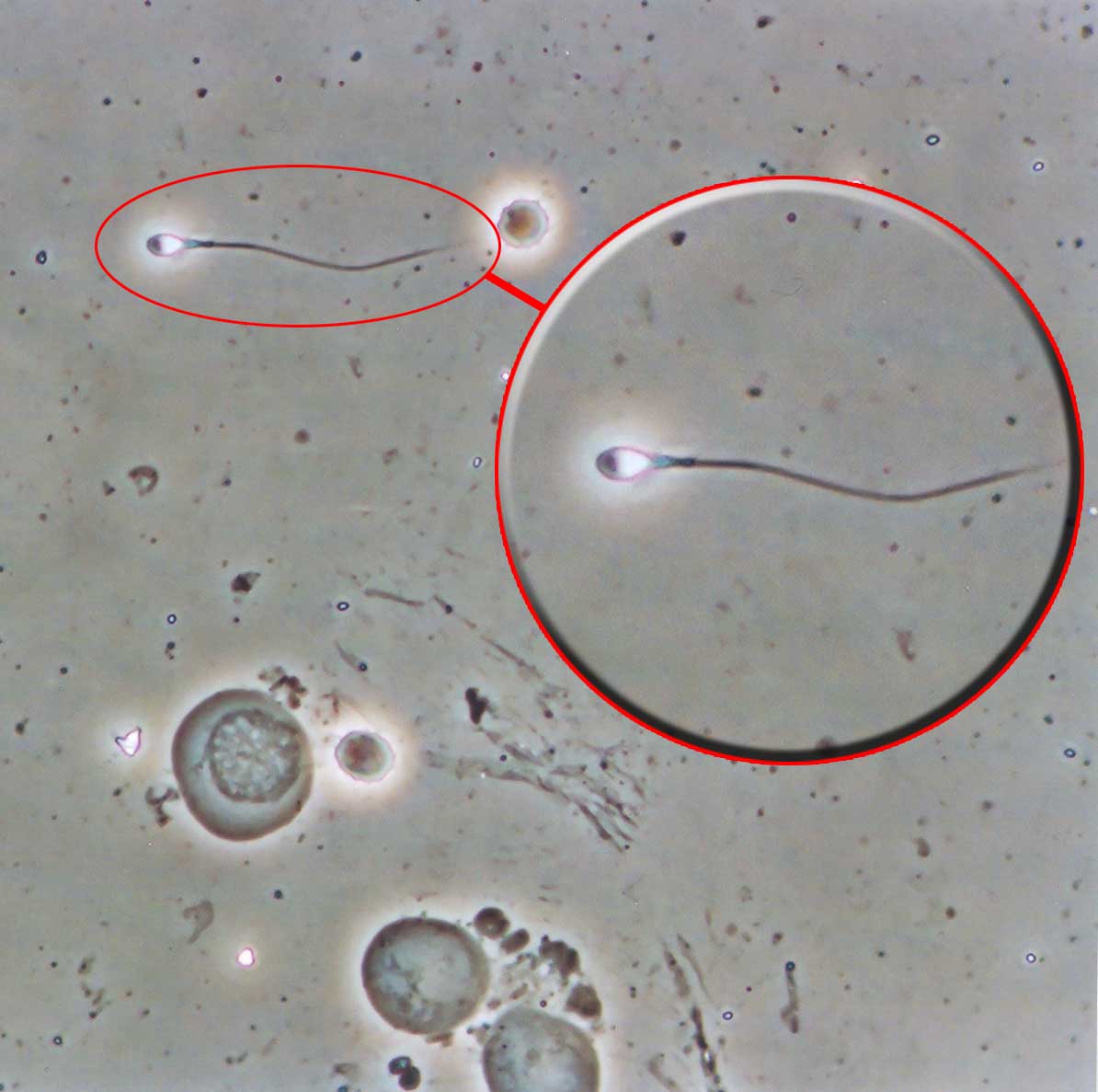 спермы что можно увидеть фото 71